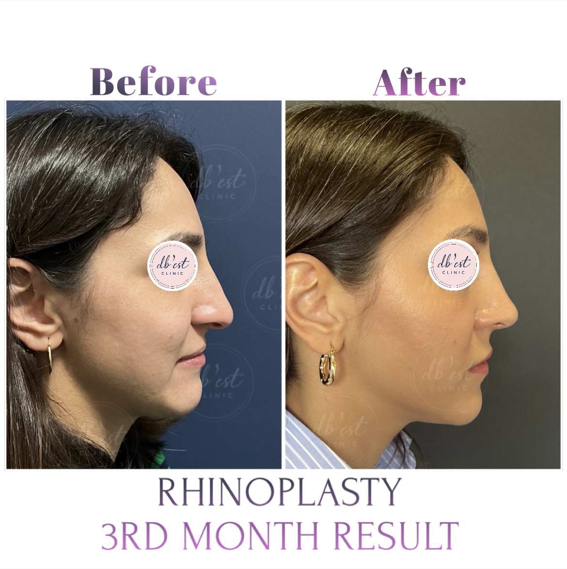 13FAE14F-413B-4FF6-88B2-3351ABDC7FE5