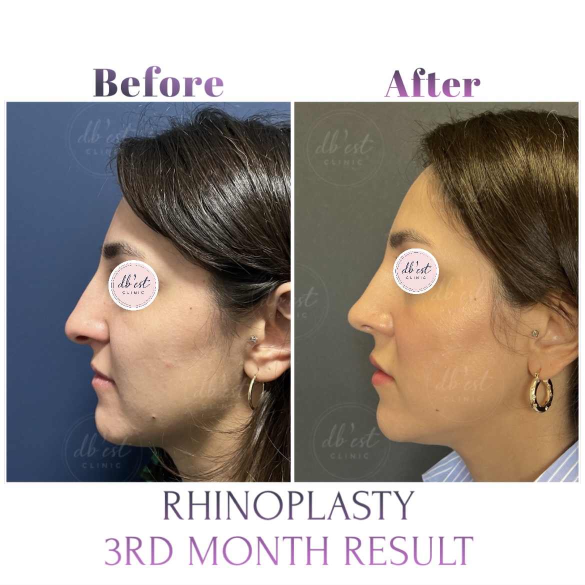 69923962-790D-426B-B5A1-23EAA18C13FB