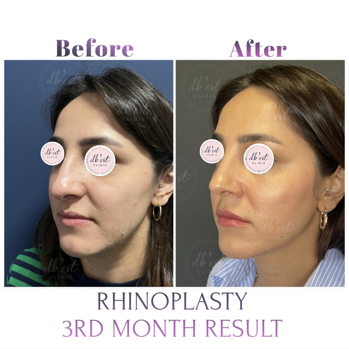 A45D09BE-9391-4F2C-A7DE-CFF2C247B948