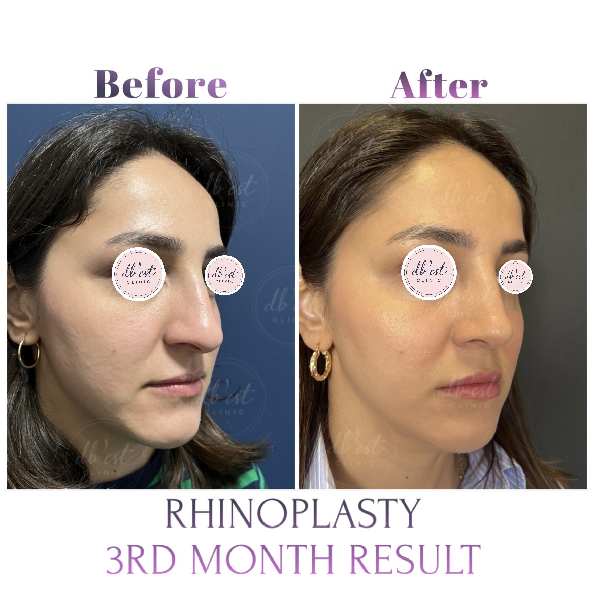 F3616575-BAF2-420F-8329-CB77BF121C18